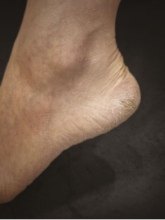 Magic Padi - Foot File