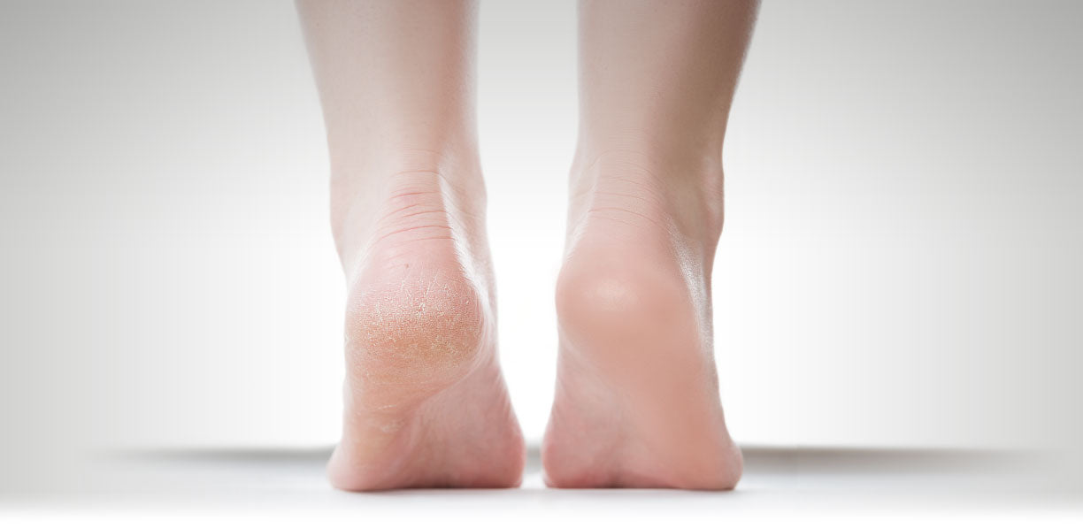 Magic Padi - Foot File